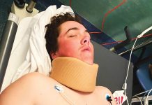 Courageous Casey on road to recovery